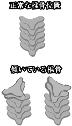 後ろから見た背骨椎骨の画像